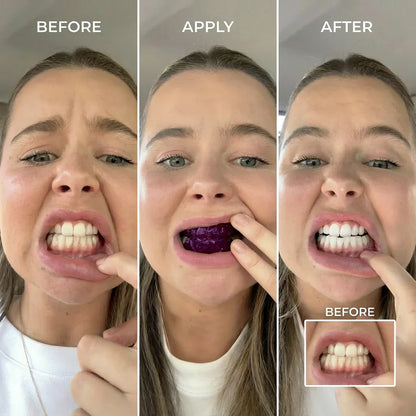 Tribeca Purple Teeth Whitening Strips